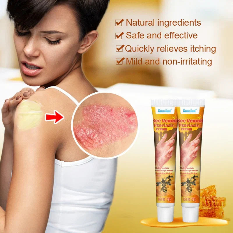 Sumifun Bee Venom Psoriasis Cream – Fast Itch Relief, Anti-Fungal & Skin Repair Treatment (20g)