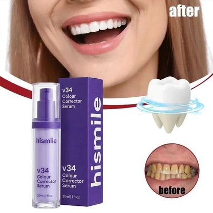 HiSmile V34 Teeth Whitening Purple Toothpaste – Color Corrector Serum for Yellow Stain Removal & Bright White Teeth