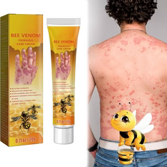 Sumifun Bee Venom Psoriasis Cream – Fast Itch Relief, Anti-Fungal & Skin Repair Treatment (20g)