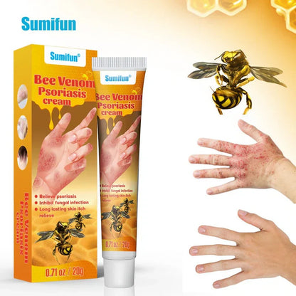 Sumifun Bee Venom Psoriasis Cream – Fast Itch Relief, Anti-Fungal & Skin Repair Treatment (20g)